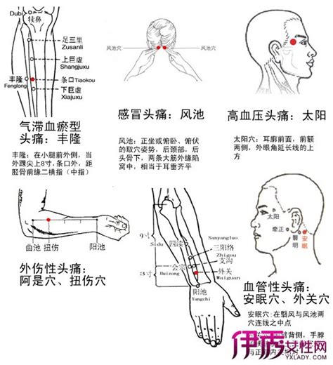 中平穴|中平穴（肩周穴,肩痛穴）